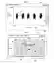 Fig. 07 - Real time voice analysis and method for providing speech therapy