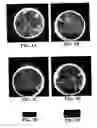 Fig. 04 - Thiol methyltransferase-based selection