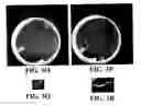 Fig. 06 - Thiol methyltransferase-based selection