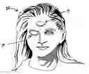 Fig. 01 - Absorbent eyelid protector and method