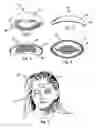 Fig. 02 - Absorbent eyelid protector and method