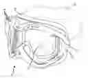 Fig. 01 - Thermal goggle lens assembly with externally vented chamber