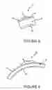 Fig. 06 - Thermal goggle lens assembly with externally vented chamber