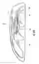 Fig. 72 - Hospital bed