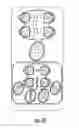 Fig. 98 - Hospital bed