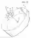Fig. 12 - Method and apparatus for preventing leakage of bodily fluids and other fluids during embalming to preserve the dignity of the deceased during memorial services