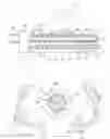 Fig. 03 - System and method for removing extrusion screw elements