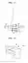 Fig. 08 - Method for removing a crack in an electromechanical rotor