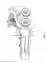 Fig. 02 - Snow pusher