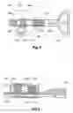 Fig. 06 - Joiner