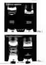 Fig. 03 - Process for aseptic vacuum filling and stoppering of low viscosity liquids in syringes