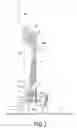 Fig. 04 - Adjustable drum pedal assembly