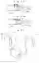 Fig. 11 - Beverage extractor