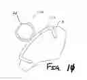 Fig. 10 - Servomechanical inker for a container decorator