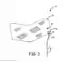 Fig. 04 - WRIST FLAG DEVICE