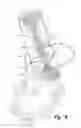 Fig. 09 - Rotating barrel type internal combustion engine