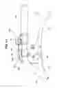Fig. 16 - Enigne-driven work machine