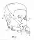 Fig. 02 - Headgear