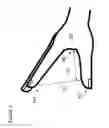 Fig. 07 - Volume-adjustable manual ventilation device