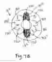 Fig. 11 - Volume-adjustable manual ventilation device