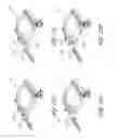 Fig. 17 - Volume-adjustable manual ventilation device