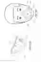 Fig. 25 - Volume-adjustable manual ventilation device
