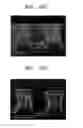 Fig. 11 - Cleaning process