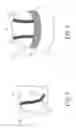 Fig. 04 - Manufacturing method for a seamless hat
