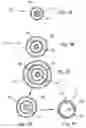 Fig. 04 - Catheters with lubricious linings and methods for making and using them