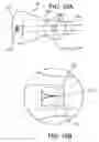 Fig. 20 - Catheters with lubricious linings and methods for making and using them
