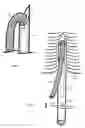 Fig. 02 - U-shaped disc shunt and delivery device