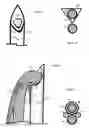 Fig. 05 - U-shaped disc shunt and delivery device