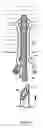 Fig. 07 - U-shaped disc shunt and delivery device