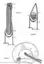Fig. 17 - U-shaped disc shunt and delivery device