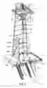 Fig. 09 - METHOD AND APPARATUS FOR DRILLING WITH CASING