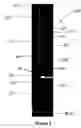 Fig. 03 - System and method for unloading water from gas wells