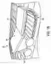 Fig. 14 - Transport vehicle and method