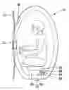 Fig. 01 - Emergency release apparatus