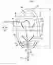 Fig. 02 - Emergency release apparatus