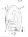 Fig. 09 - Emergency release apparatus