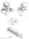 Fig. 03 - Inline skate brake