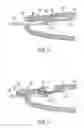 Fig. 04 - Strip ejection system