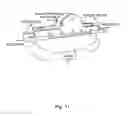 Fig. 12 - Cable pulling device