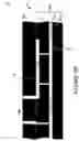 Fig. 23 - Wafer encapsulated microelectromechanical structure and method of manufacturing same