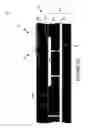 Fig. 11 - Wafer encapsulated microelectromechanical structure and method of manufacturing same