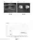 Fig. 05 - Mold flash removal process for electronic devices