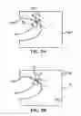 Fig. 08 - Variable rate stabilizer bar