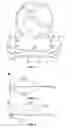Fig. 04 - Levitation device