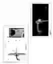 Fig. 03 - Plasma generating devices and methods for using the same