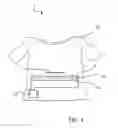 Fig. 05 - Fabric-based strain gauge